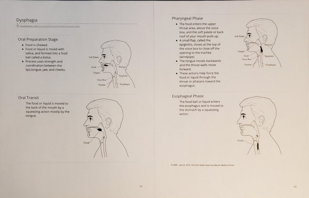 Patient education about the 4 stages of swallowing.